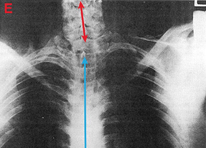 X-raycopy_zps105bf284.jpg